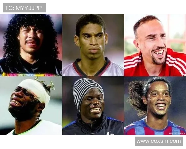 足球明星整容真相揭秘他们的外貌变化背后的故事 足球明星整容真相揭秘他们的外貌变化背后的故事